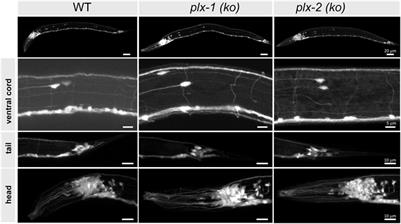 Semaphorin signaling restricts neuronal regeneration in C. elegans